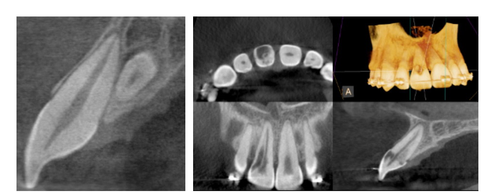 Midland CBCT